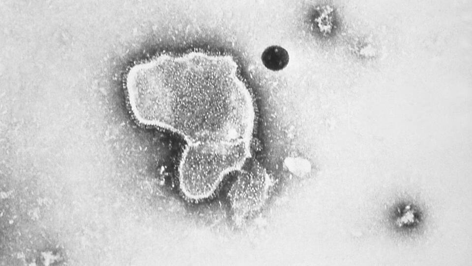 A black-and-white image of a virus under a microscope.