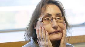 Obit Connie Culp Face Transplant
