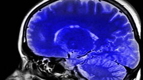 brain.jpg