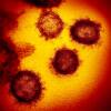 SARS-CoV-2 is shown in this colorized transmission electron micrograph. This specimen was isolated from a patient in the U.S. Particles of the virus are shown emerging from the surface of cells cultured in the lab.