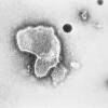 A black-and-white image of a virus under a microscope.