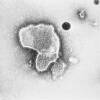 Health experts agree that the unseasonably early surges of RSV cases, especially among children, are a consequence of lifting COVID-19 precautions, which served to protect the public from a variety of viruses.