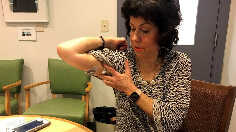 Deidre Waxman of Newton, a social worker at the Brookline Senior Center who has Type I diabetes, displays her external glucose monitor that measures her blood sugar levels. 12/21/18