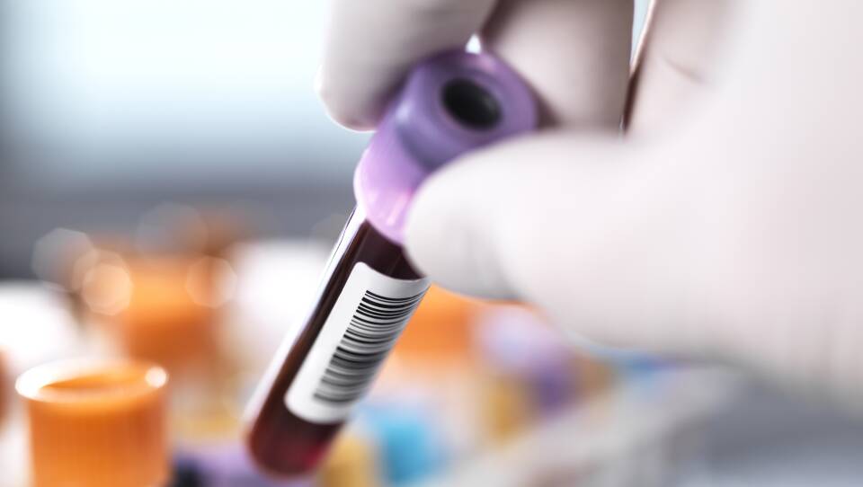 Health screening