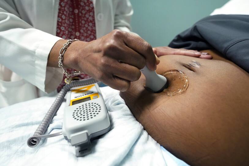 A doctor holds a small wand against the lubricated belly of a pregnant woman in a hospital room.