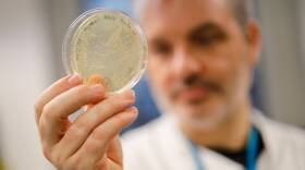 Paul McKay, a molecular immunologist at the Imperial College School of Medicine in London, checks a dish of bacteria containing genetic material from the new coronavirus. He and his team are testing a candidate vaccine.