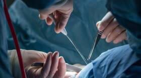 surgery-bebda2464094cfbe86edf9dfe5339ab9f05b71aa.jpg