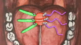 What Really Causes Cavities?