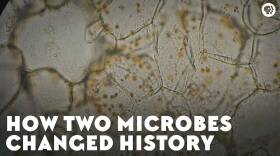 How Two Microbes Changed History